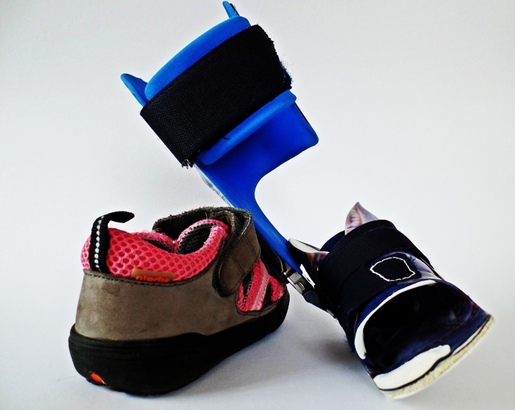 History of the orthotic devices  Reh4Mat – lower limb orthosis